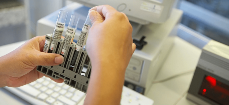 Imagen de archivo de unas pruebas de diagnóstico de viruela del mono / TA